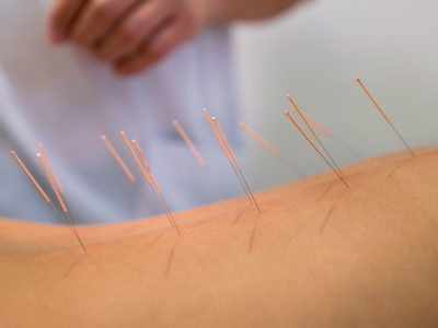 Points of Wellness Acupuncture by Anh Tran